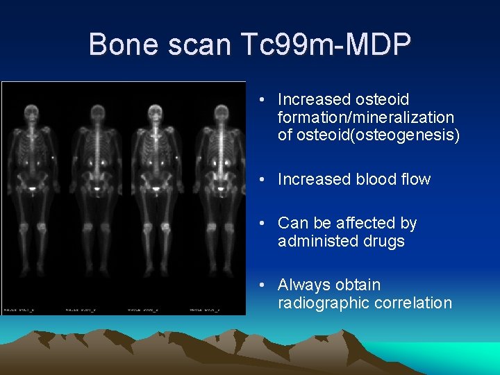 Bone scan Tc 99 m-MDP • Increased osteoid formation/mineralization of osteoid(osteogenesis) • Increased blood