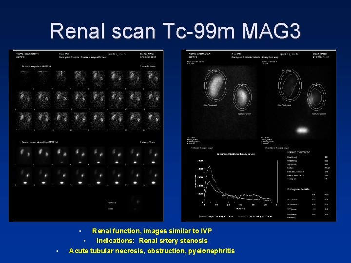 Renal scan Tc-99 m MAG 3 • • Renal function, images similar to IVP