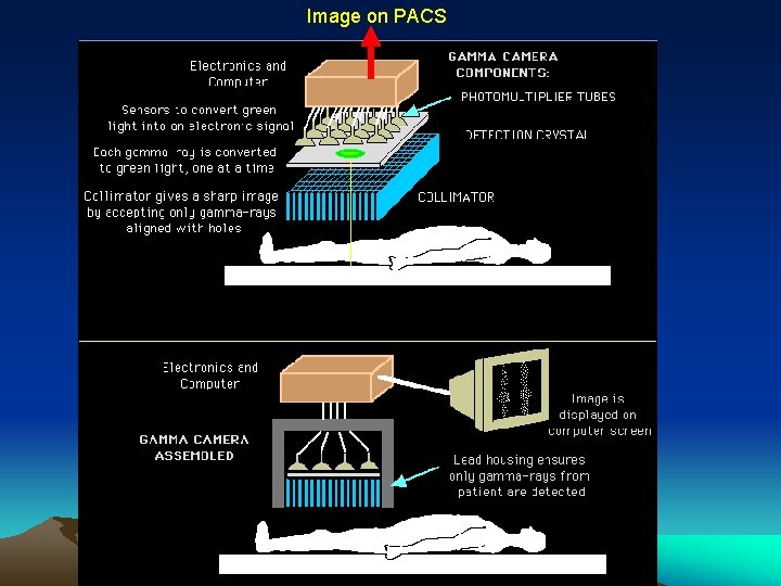 Image on PACS 