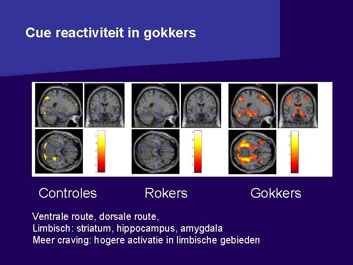 Cue reactiviteit in gokkers Controles Rokers Gokkers Ventrale route, dorsale route, Limbisch: striatum, hippocampus,