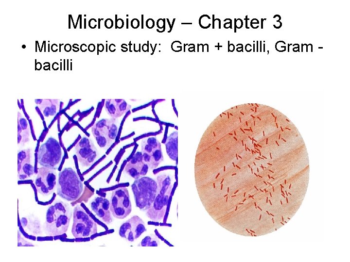 Microbiology – Chapter 3 • Microscopic study: Gram + bacilli, Gram bacilli 