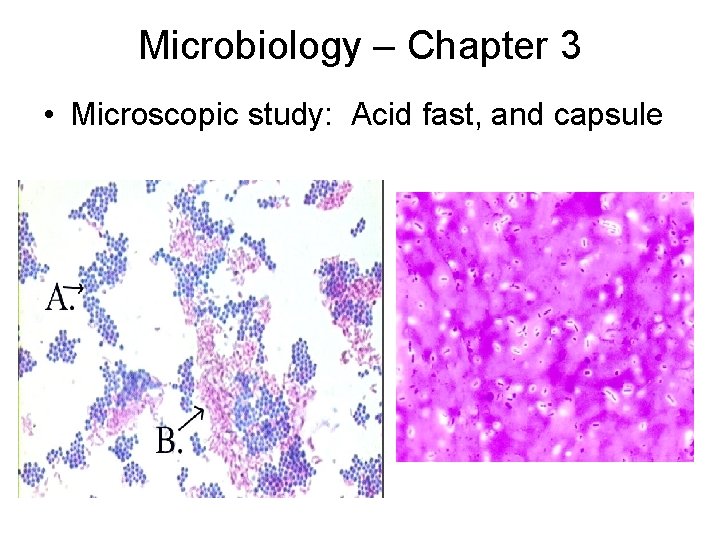 Microbiology – Chapter 3 • Microscopic study: Acid fast, and capsule 