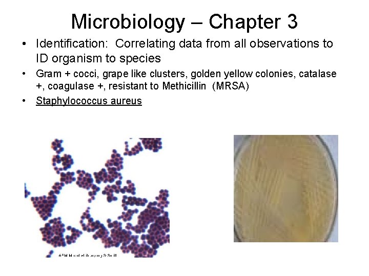 Microbiology – Chapter 3 • Identification: Correlating data from all observations to ID organism