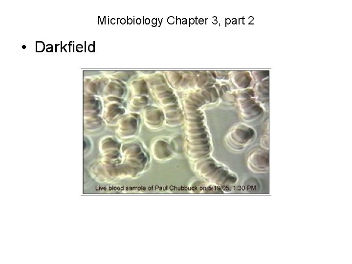 Microbiology Chapter 3, part 2 • Darkfield 