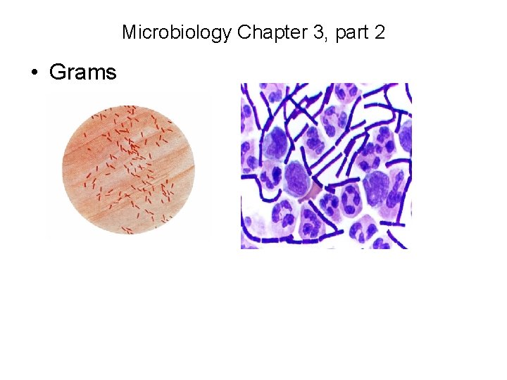 Microbiology Chapter 3, part 2 • Grams 