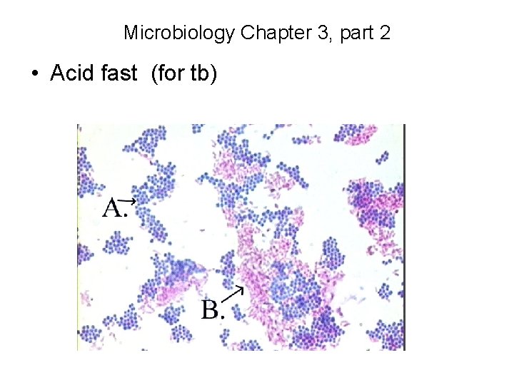 Microbiology Chapter 3, part 2 • Acid fast (for tb) 