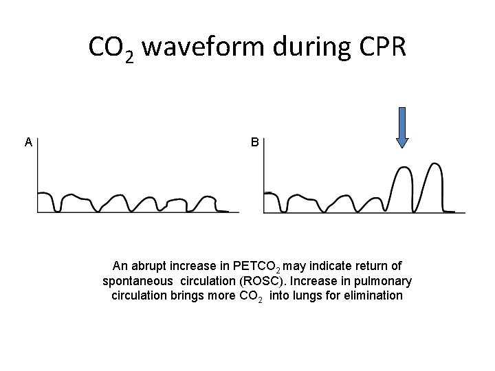CO 2 waveform during CPR A B An abrupt increase in PETCO 2 may