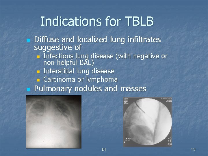 Indications for TBLB n Diffuse and localized lung infiltrates suggestive of n n Infectious