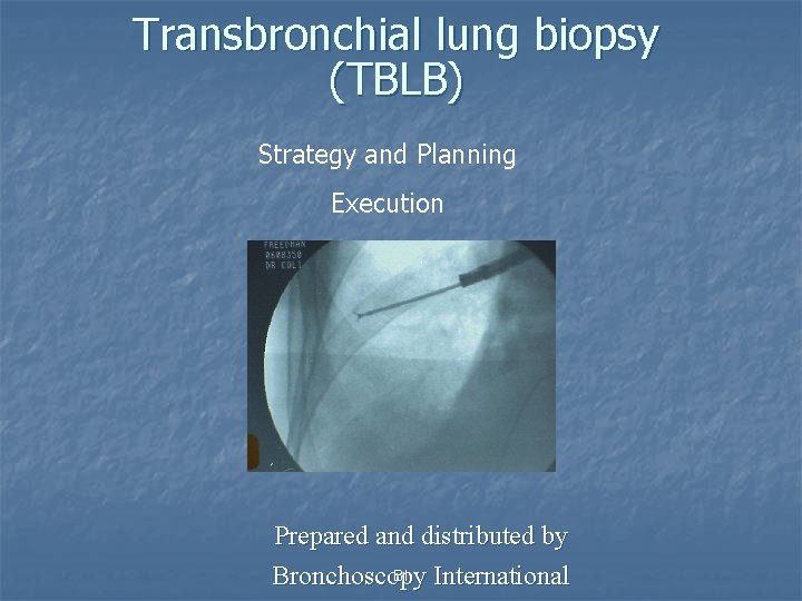 Transbronchial lung biopsy (TBLB) Strategy and Planning Execution Prepared and distributed by BI Bronchoscopy