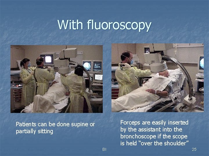 With fluoroscopy Forceps are easily inserted by the assistant into the bronchoscope if the