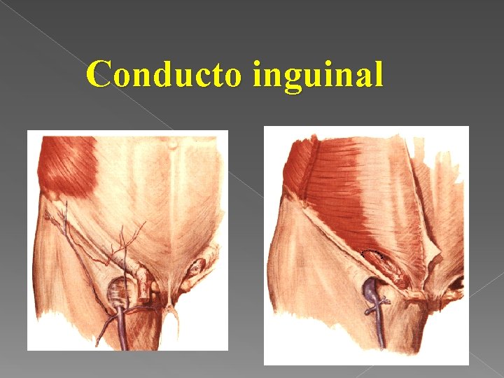 Conducto inguinal 