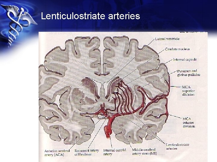 Lenticulostriate arteries 