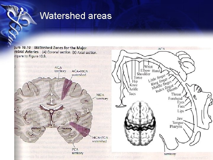 Watershed areas 