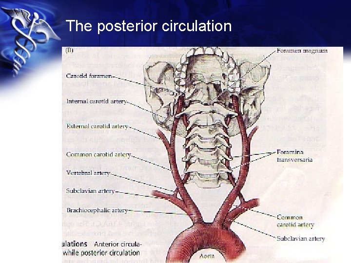 The posterior circulation 