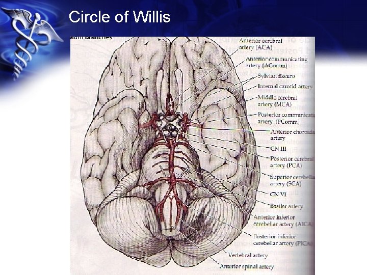 Circle of Willis 