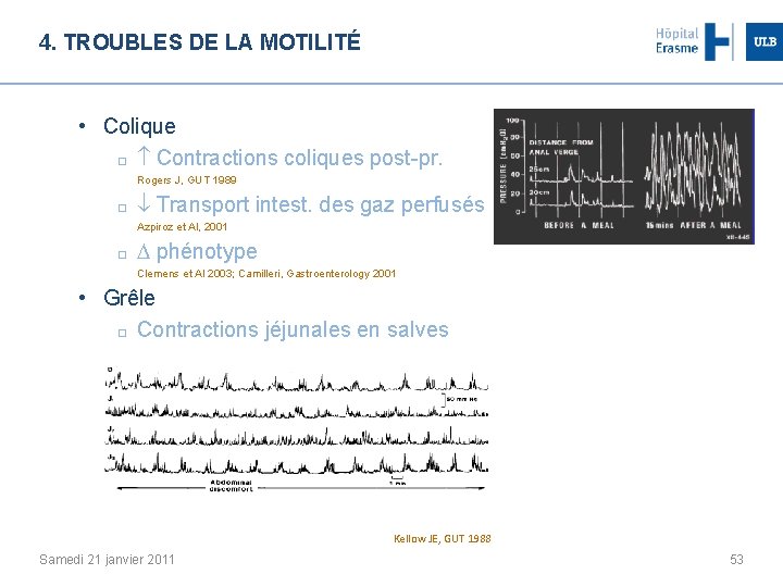 4. TROUBLES DE LA MOTILITÉ • Colique Contractions coliques post-pr. Rogers J, GUT 1989