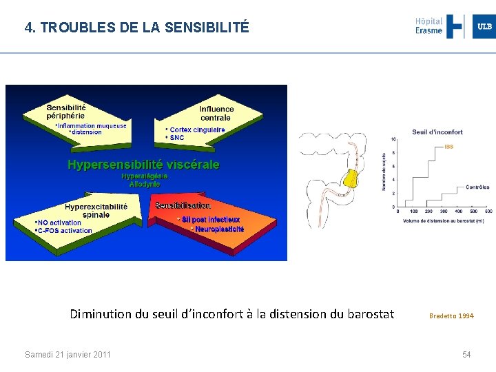 4. TROUBLES DE LA SENSIBILITÉ Diminution du seuil d’inconfort à la distension du barostat