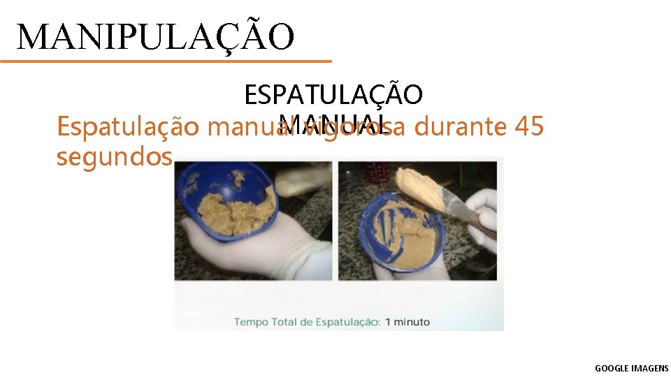 MANIPULAÇÃO ESPATULAÇÃO MANUAL Espatulação manual vigorosa durante 45 segundos GOOGLE IMAGENS 