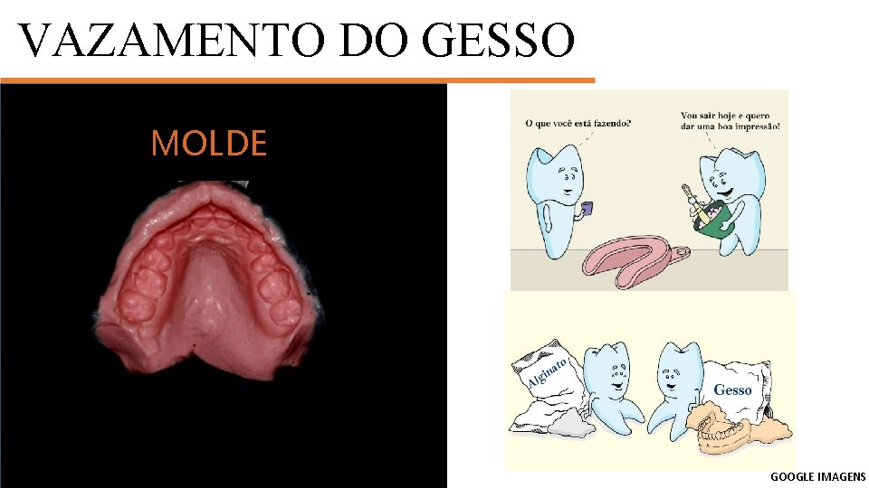 VAZAMENTO DO GESSO MANIPULAÇÃO MOLDE GOOGLE IMAGENS 