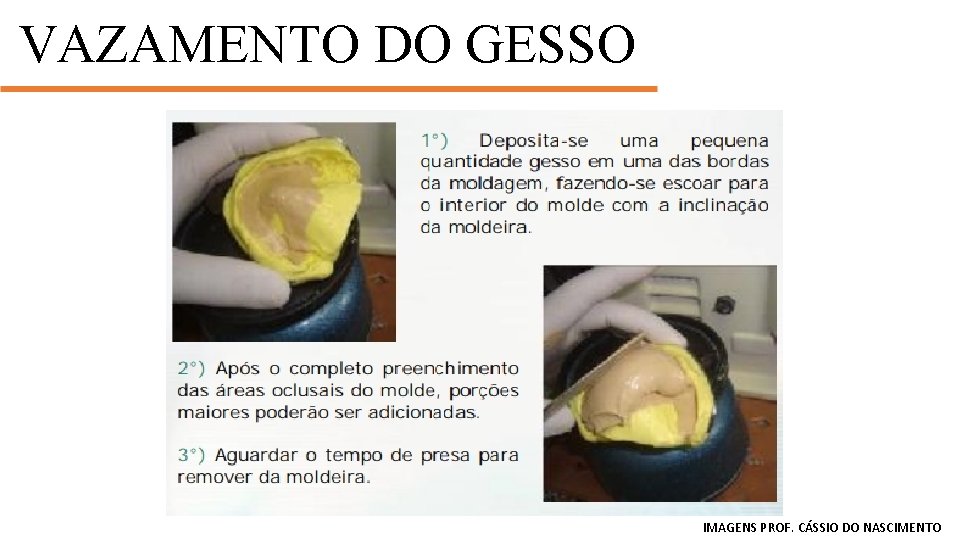 VAZAMENTO DO GESSO MANIPULAÇÃO IMAGENS PROF. CÁSSIO DO NASCIMENTO 