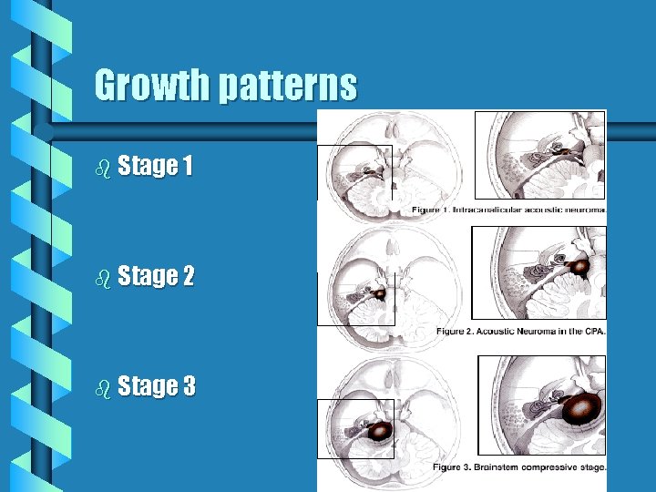 Growth patterns b Stage 1 b Stage 2 b Stage 3 