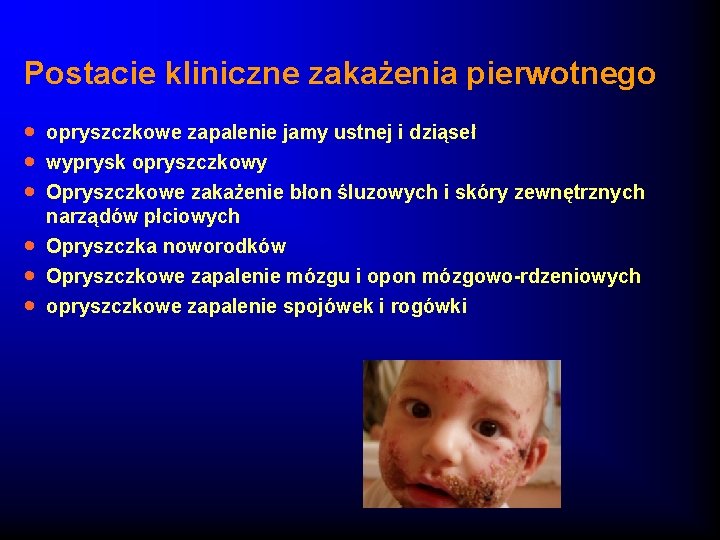 Postacie kliniczne zakażenia pierwotnego · · · opryszczkowe zapalenie jamy ustnej i dziąseł wyprysk