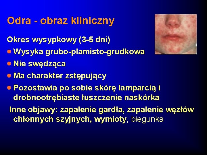 Odra - obraz kliniczny Okres wysypkowy (3 -5 dni) · Wysyka grubo-plamisto-grudkowa · Nie