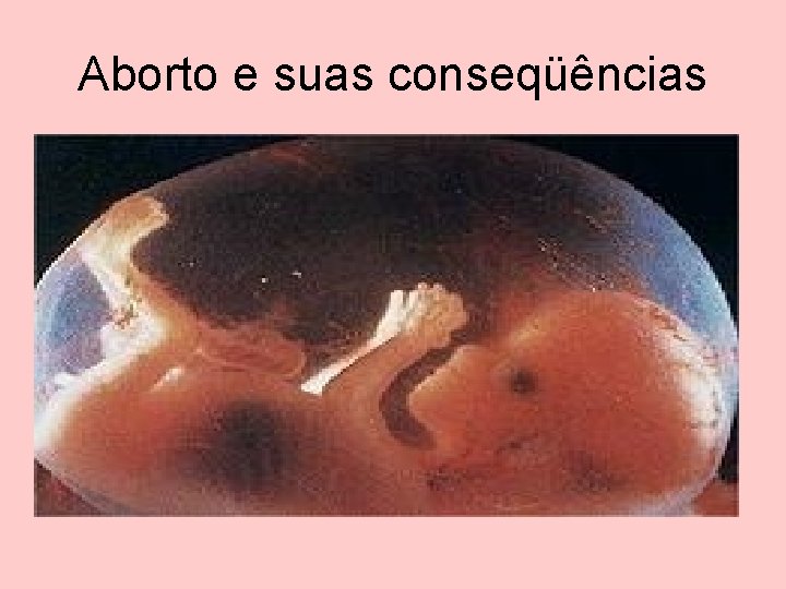 Aborto e suas conseqüências 