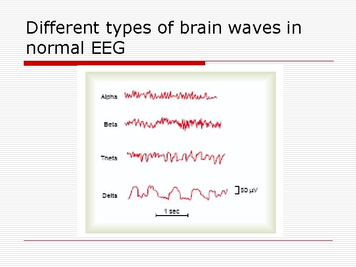 Different types of brain waves in normal EEG 