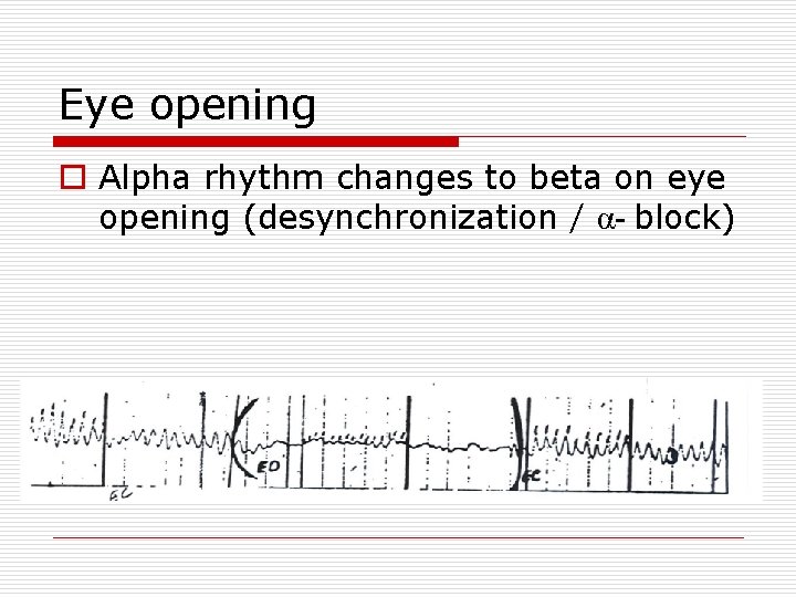 Eye opening o Alpha rhythm changes to beta on eye opening (desynchronization / α-