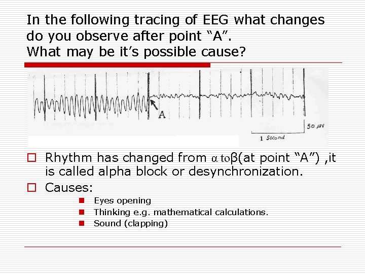 In the following tracing of EEG what changes do you observe after point “A”.