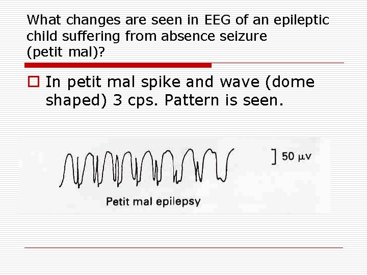 What changes are seen in EEG of an epileptic child suffering from absence seizure