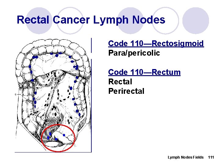 Rectal Cancer Lymph Nodes Code 110—Rectosigmoid Para/pericolic Code 110—Rectum Rectal Perirectal Lymph Nodes Fields