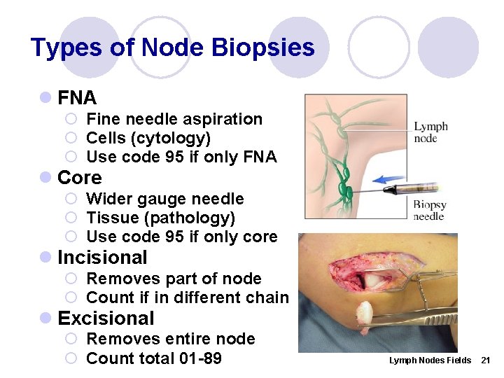 Types of Node Biopsies l FNA ¡ Fine needle aspiration ¡ Cells (cytology) ¡