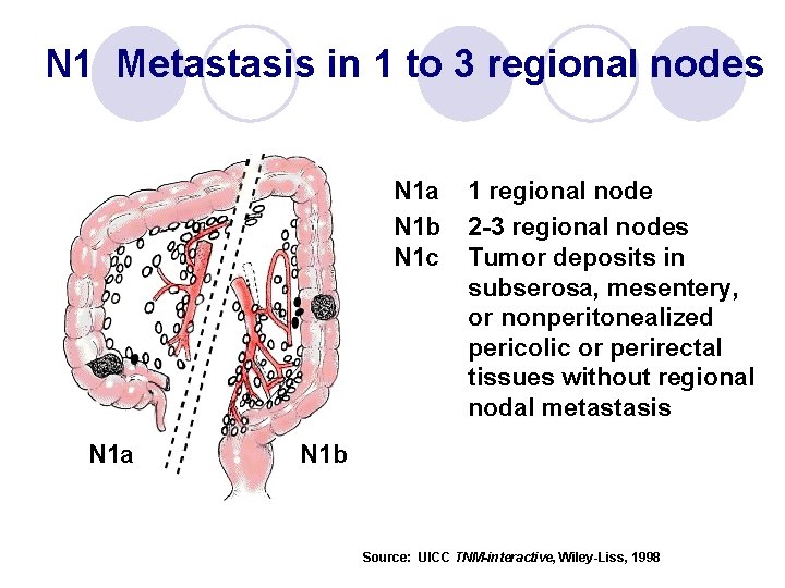 N 1 Metastasis in 1 to 3 regional nodes N 1 a N 1