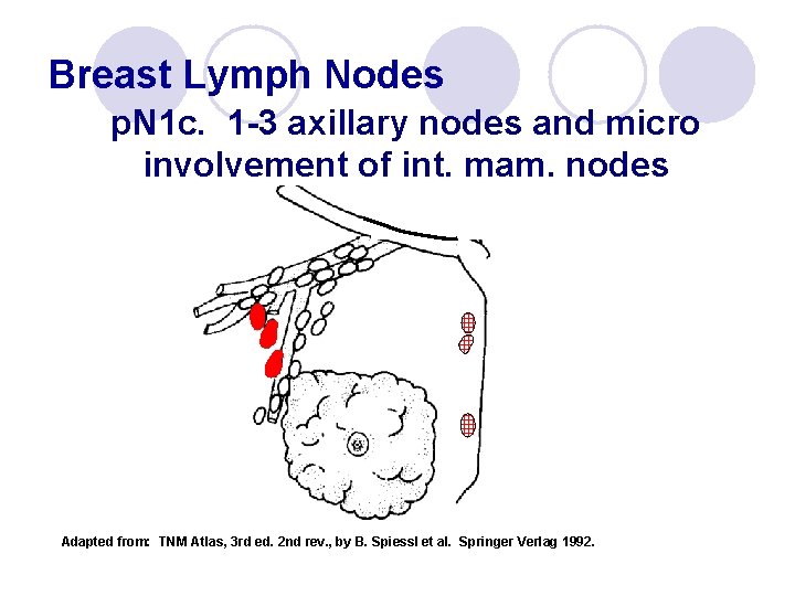 Breast Lymph Nodes p. N 1 c. 1 -3 axillary nodes and micro involvement