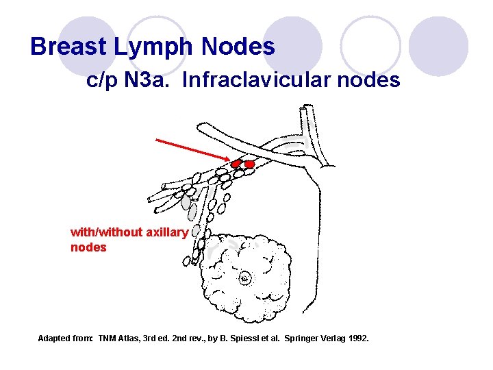 Breast Lymph Nodes c/p N 3 a. Infraclavicular nodes with/without axillary nodes Adapted from: