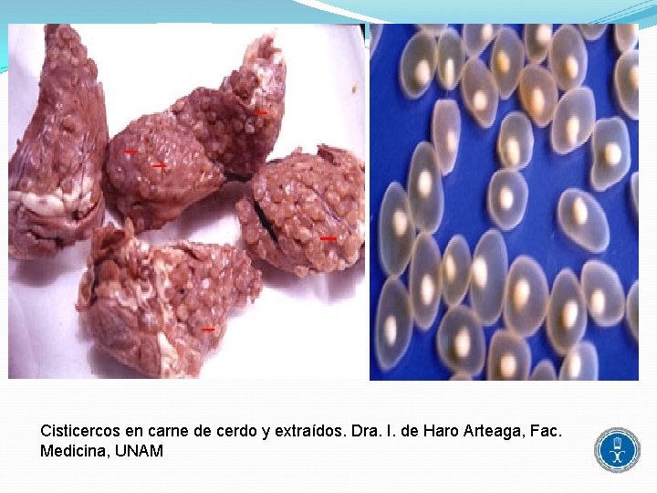 Cisticercos en carne de cerdo y extraídos. Dra. I. de Haro Arteaga, Fac. Medicina,