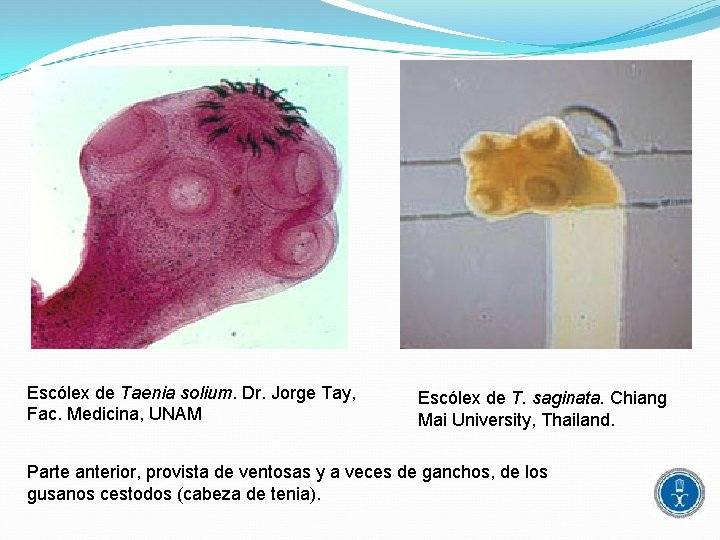 Escólex de Taenia solium. Dr. Jorge Tay, Fac. Medicina, UNAM Escólex de T. saginata.