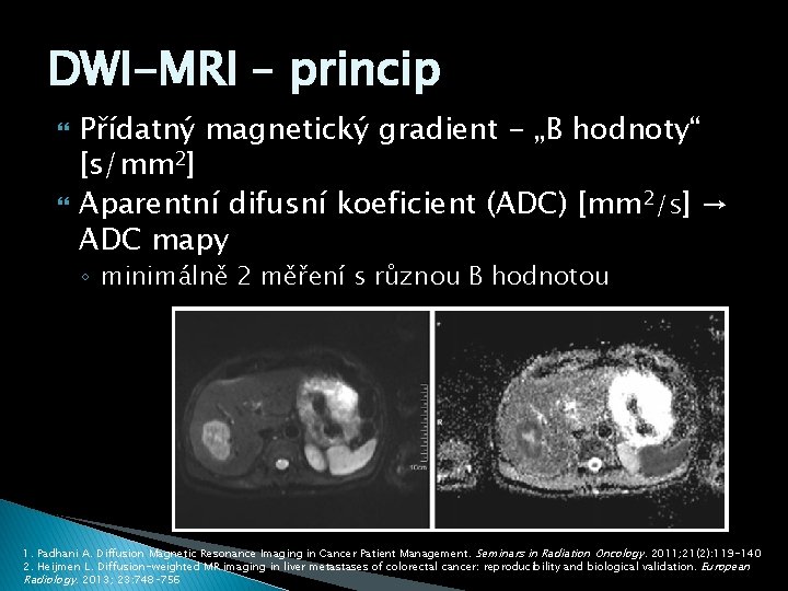DWI-MRI – princip Přídatný magnetický gradient - „B hodnoty“ [s/mm 2] Aparentní difusní koeficient