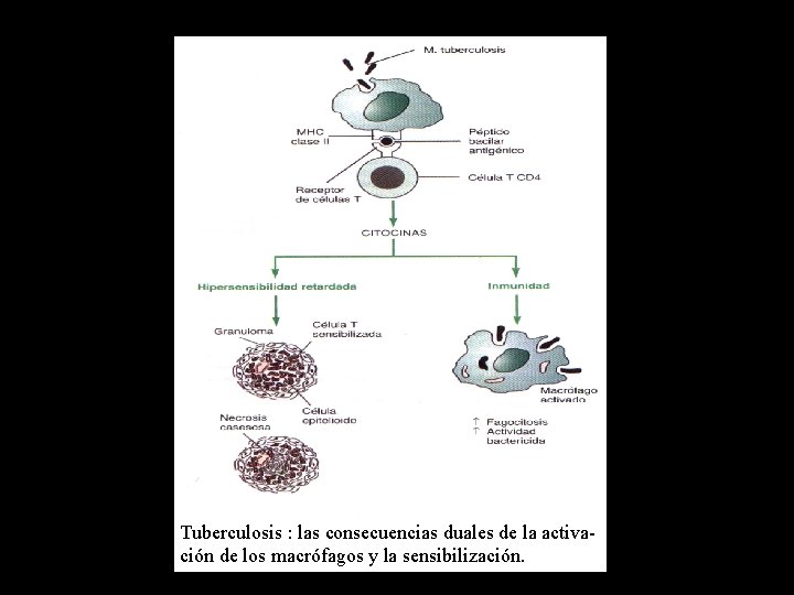 Tuberculosis : las consecuencias duales de la activación de los macrófagos y la sensibilización.