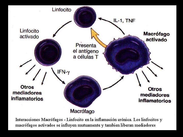 Interacciones Macrófagos - Linfocito en la inflamación crónica. Los linfocitos y macrófagos activados se