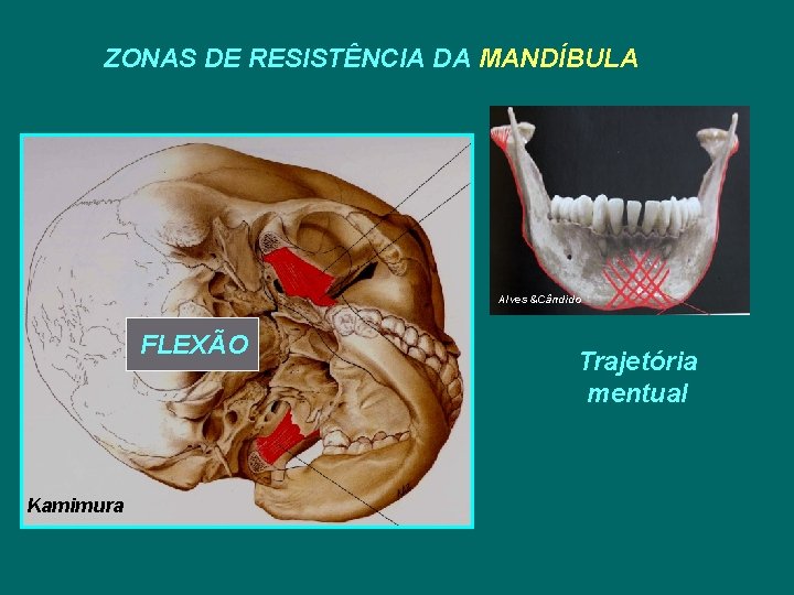 ZONAS DE RESISTÊNCIA DA MANDÍBULA Alves &Cândido FLEXÃO Kamimura Trajetória mentual 