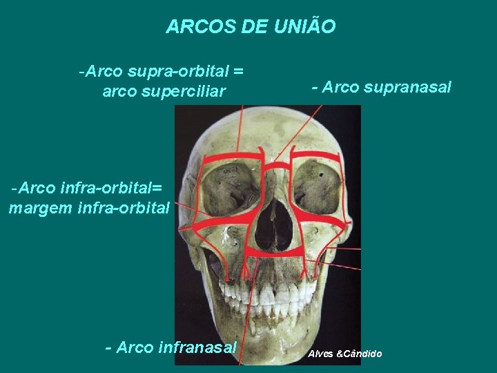 ARCOS DE UNIÃO -Arco supra-orbital = arco superciliar - Arco supranasal -Arco infra-orbital= margem