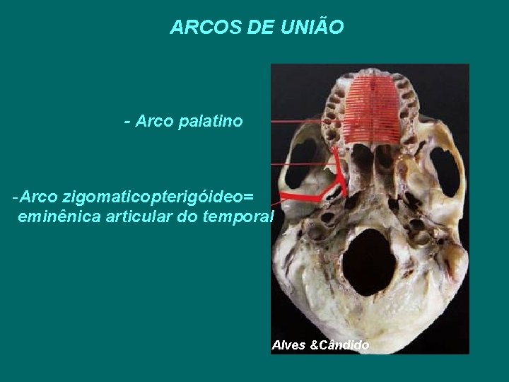 ARCOS DE UNIÃO - Arco palatino -Arco zigomaticopterigóideo= eminênica articular do temporal Alves &Cândido