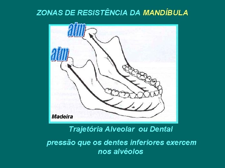 ZONAS DE RESISTÊNCIA DA MANDÍBULA Madeira Trajetória Alveolar ou Dental pressão que os dentes