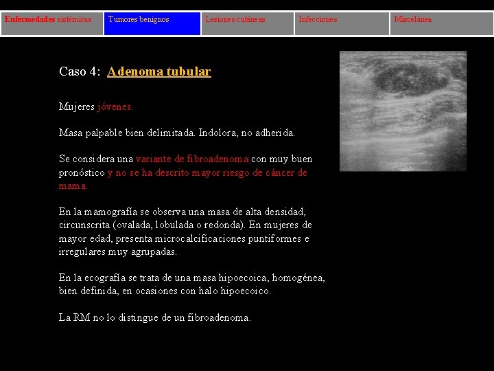 Enfermedades sistémicas Tumores benignos Lesiones cutáneas Infecciones Caso 4: Adenoma tubular Mujeres jóvenes. Masa