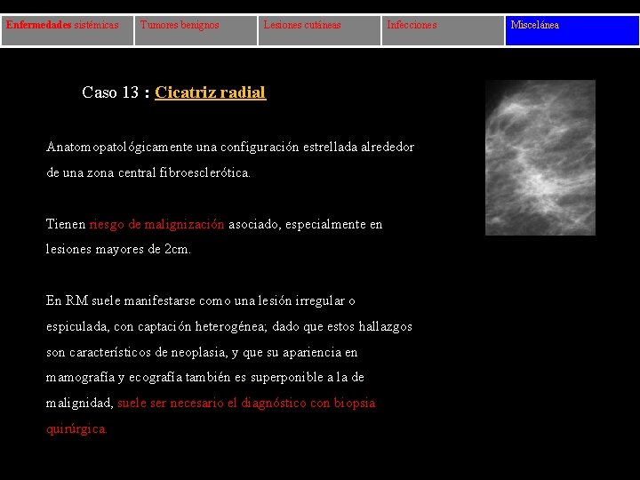 Enfermedades sistémicas Tumores benignos Lesiones cutáneas Infecciones Caso 13 : Cicatriz radial Anatomopatológicamente una