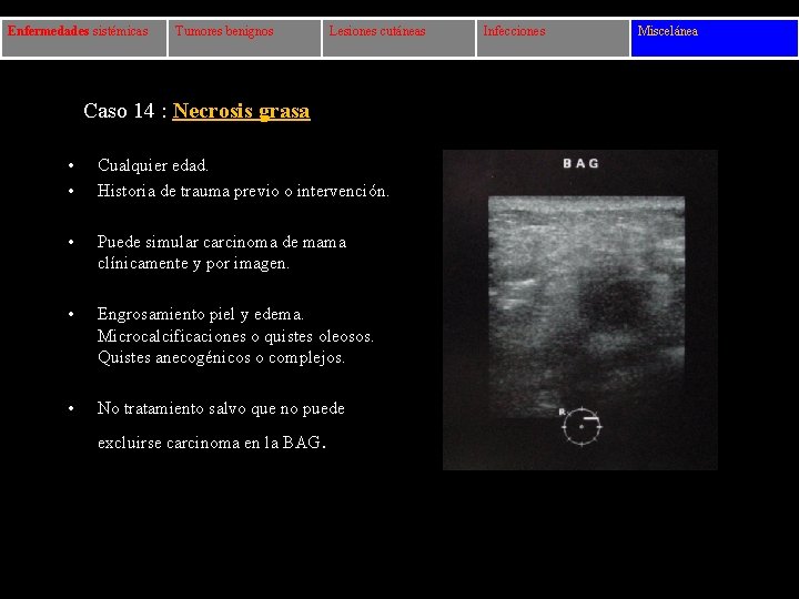 Enfermedades sistémicas Tumores benignos Lesiones cutáneas Caso 14 : Necrosis grasa • • Cualquier