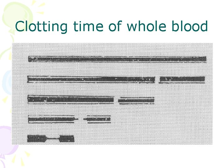 Clotting time of whole blood 